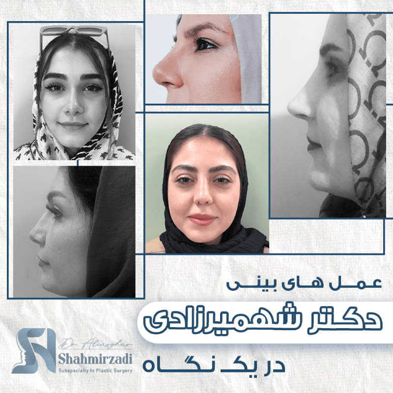 جراحی بینی