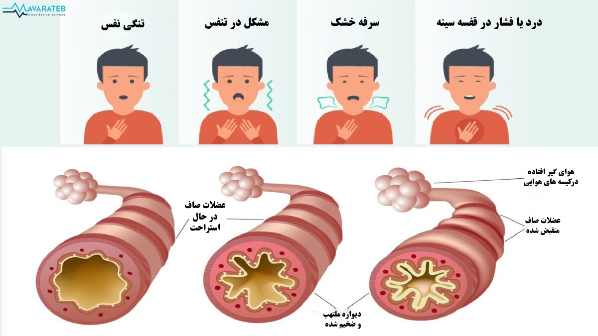 علائم برونشیت